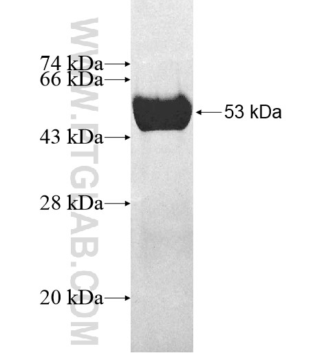 SBDS fusion protein Ag11814 SDS-PAGE