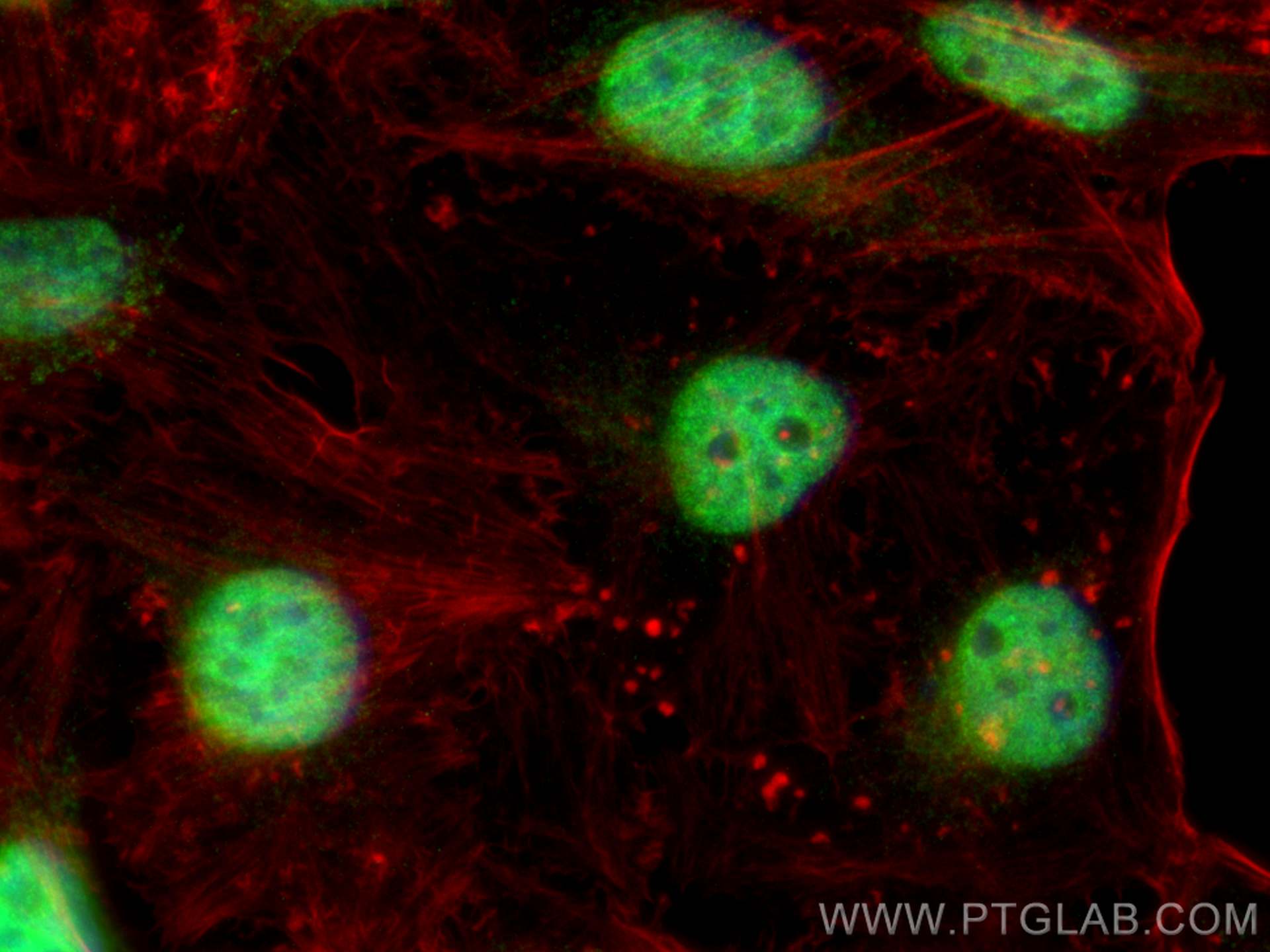 IF Staining of HeLa using 25359-1-AP