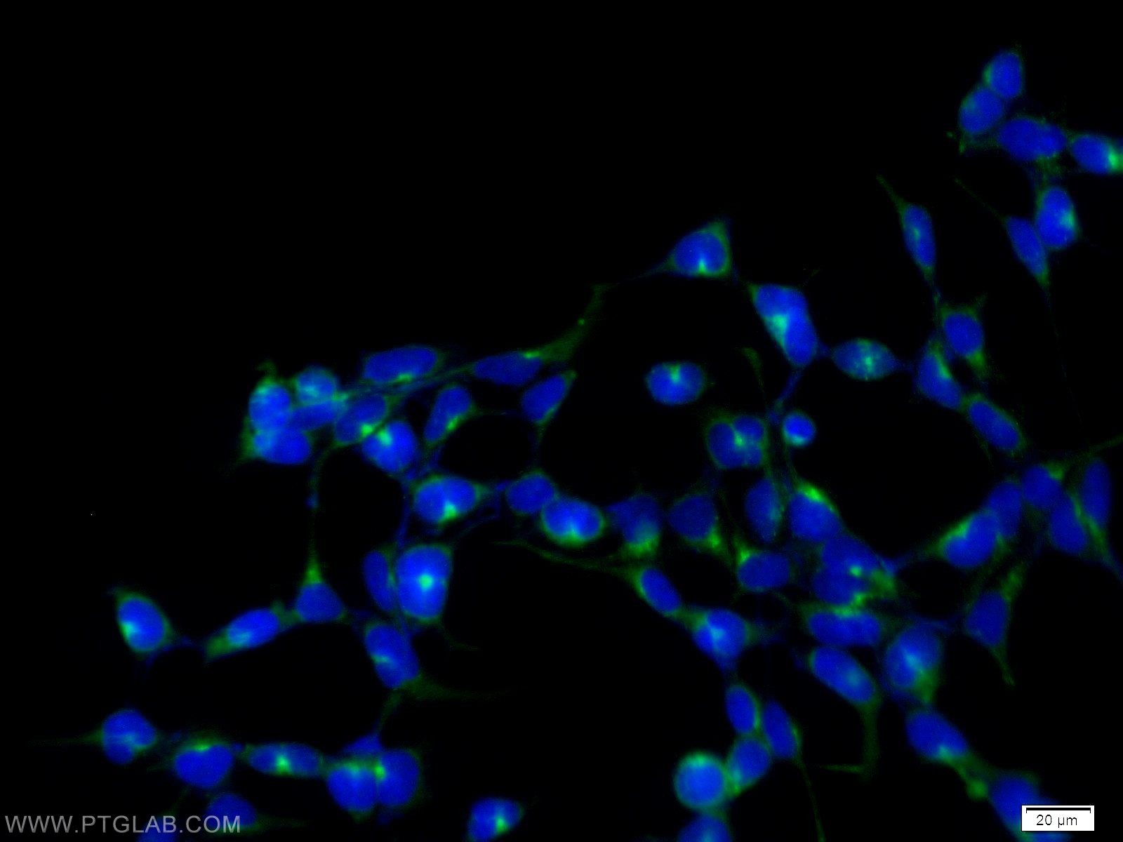 SCAMP2 Polyclonal antibody