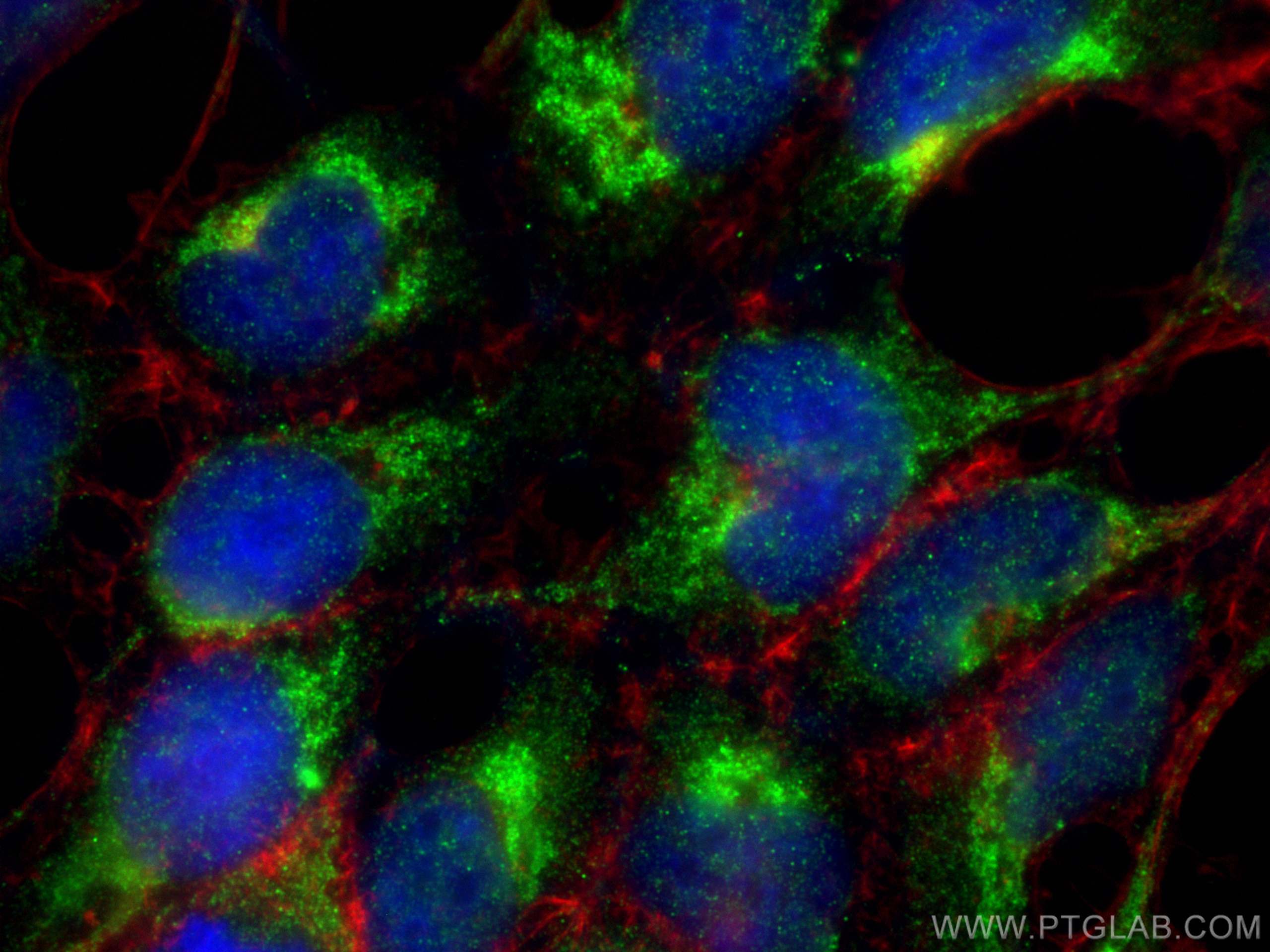 IF Staining of HEK-293 using 12266-1-AP