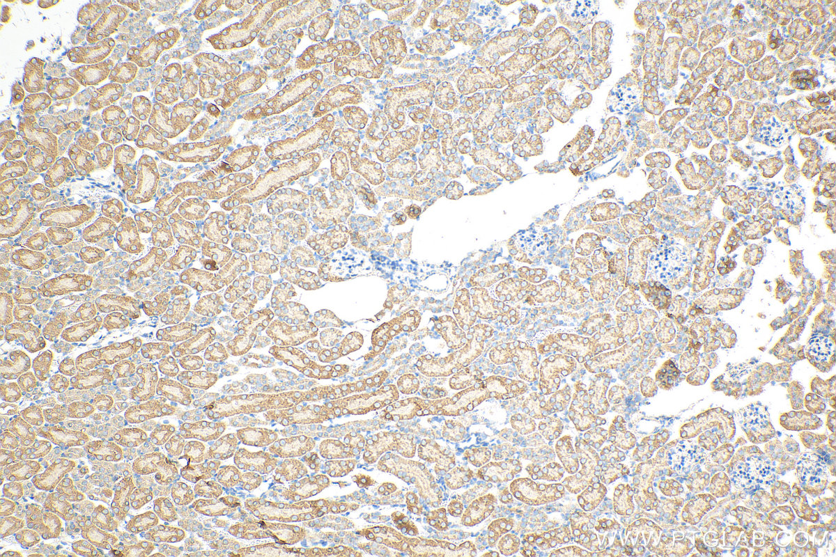 IHC staining of mouse kidney using 12266-1-AP