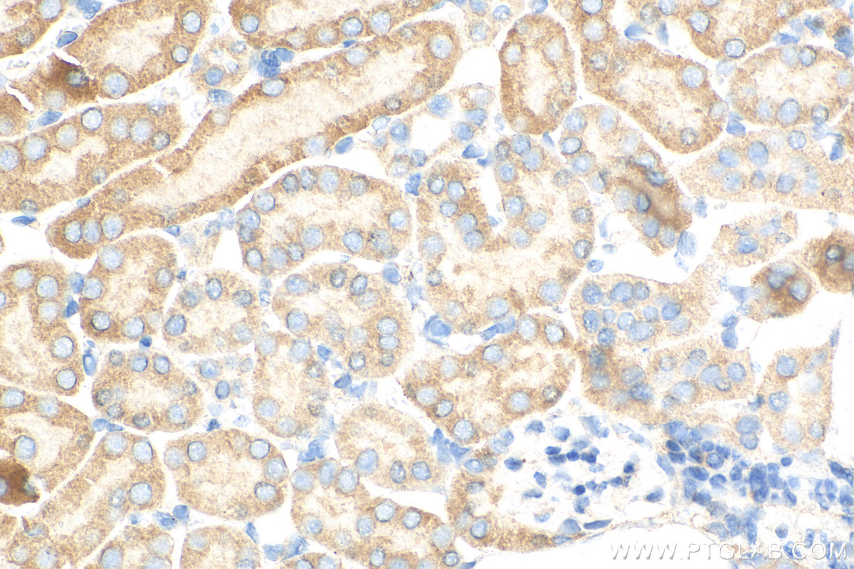 IHC staining of mouse kidney using 12266-1-AP