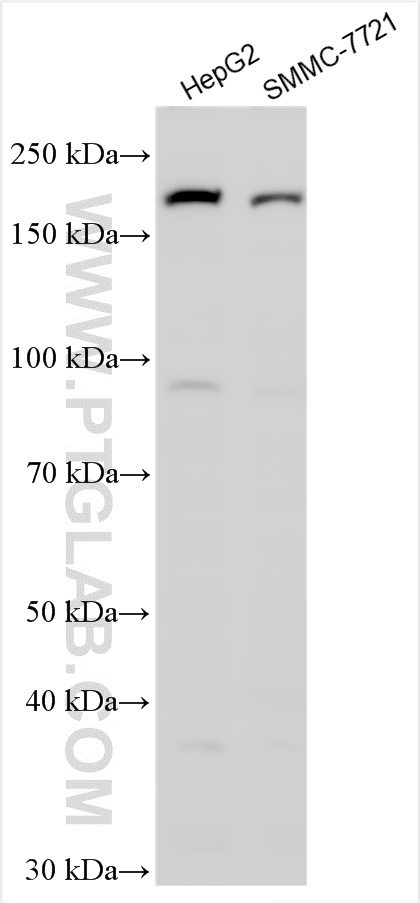 WB analysis using 28174-1-AP