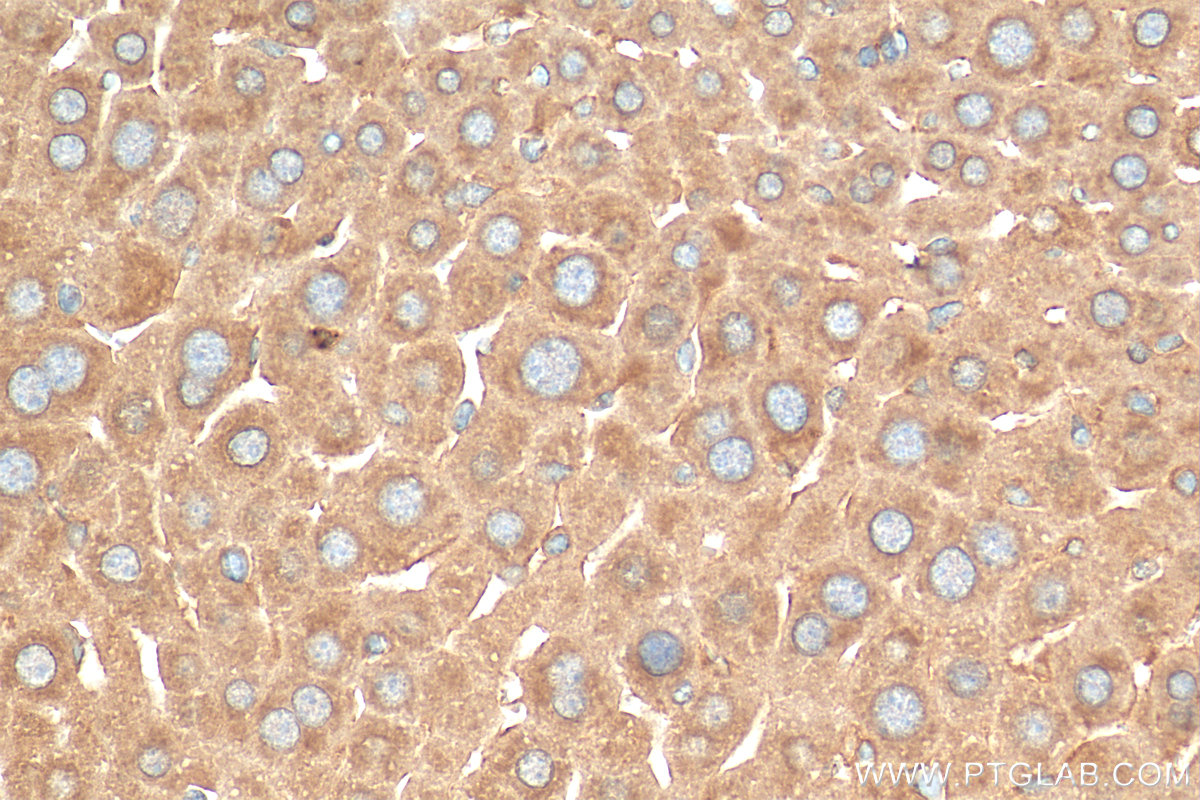 IHC staining of mouse liver using 28678-1-AP