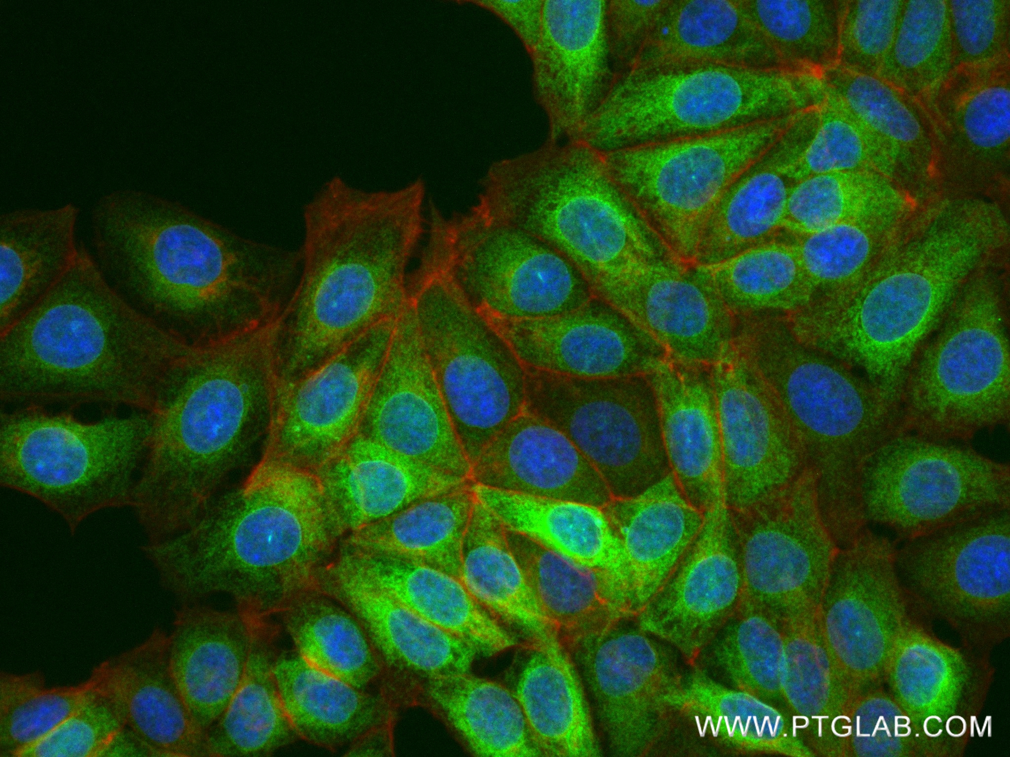 IF Staining of MCF-7 using 81468-5-RR