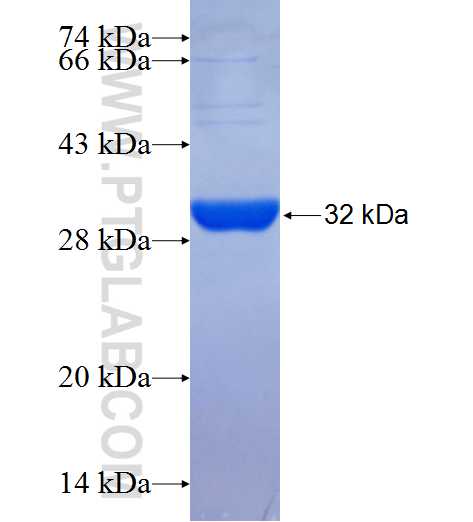 SCD5 fusion protein Ag25211 SDS-PAGE