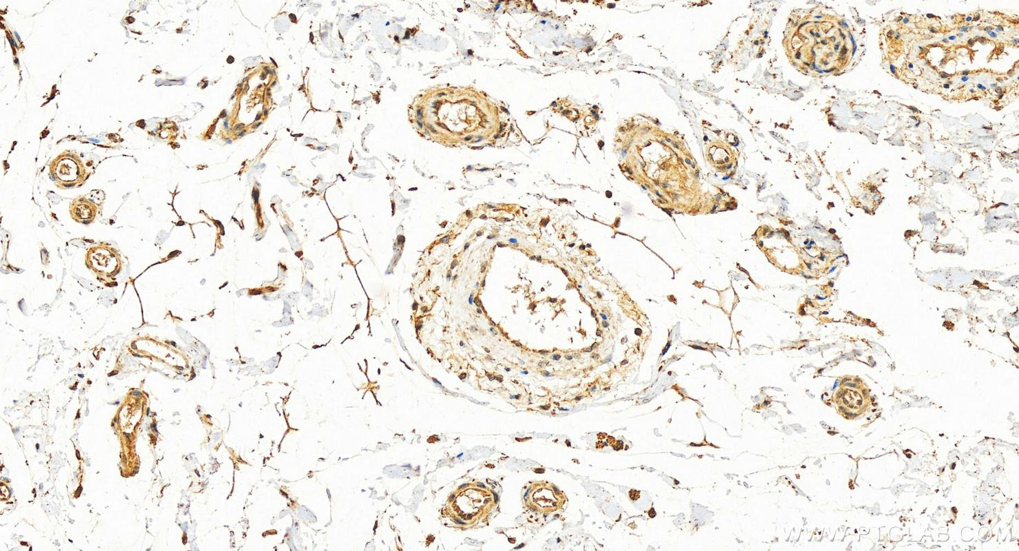 IHC staining of human colon using 13375-1-AP