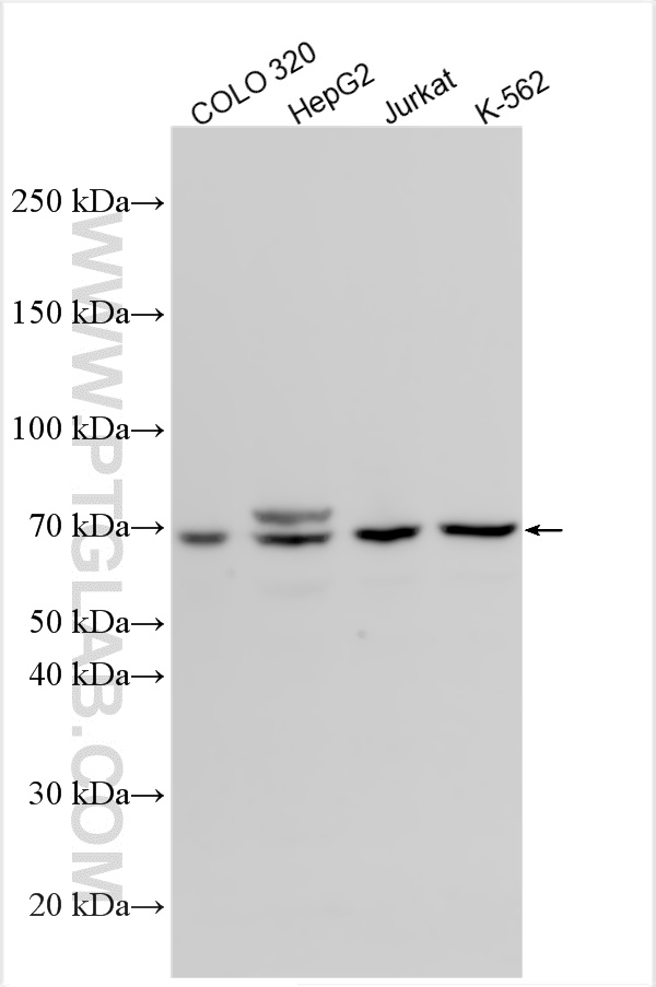 WB analysis using 13375-1-AP