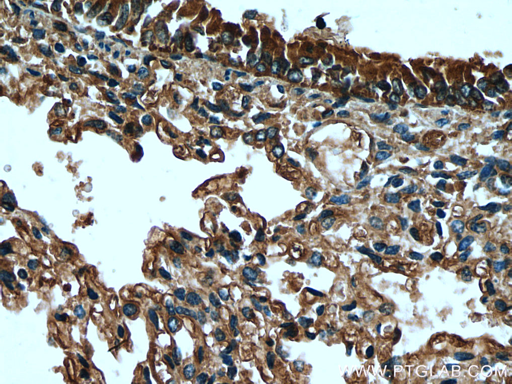 IHC staining of human lung using 26228-1-AP