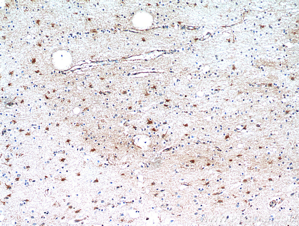 IHC staining of human brain using 21142-1-AP