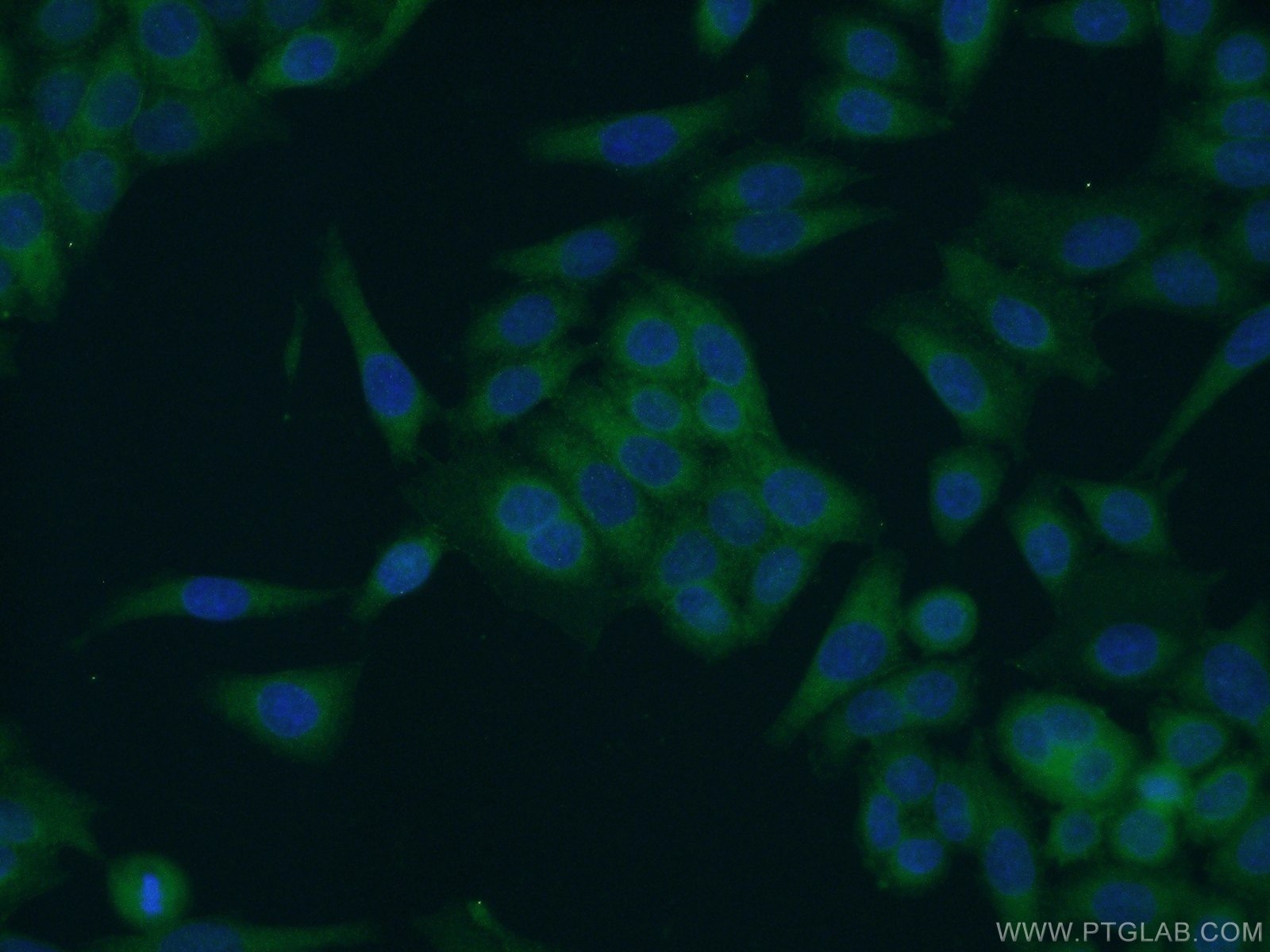 IF Staining of HeLa using 11939-1-AP