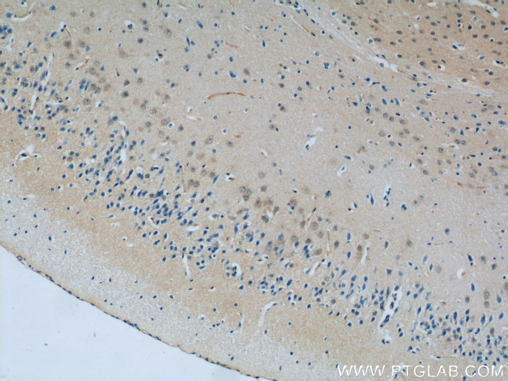 IHC staining of mouse brain using 11939-1-AP