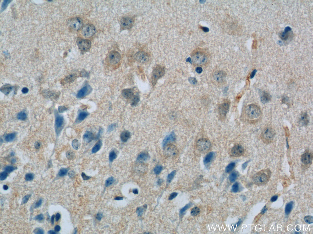 IHC staining of mouse brain using 11939-1-AP