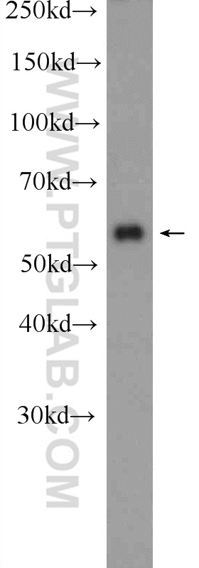 WB analysis of HeLa using 11939-1-AP