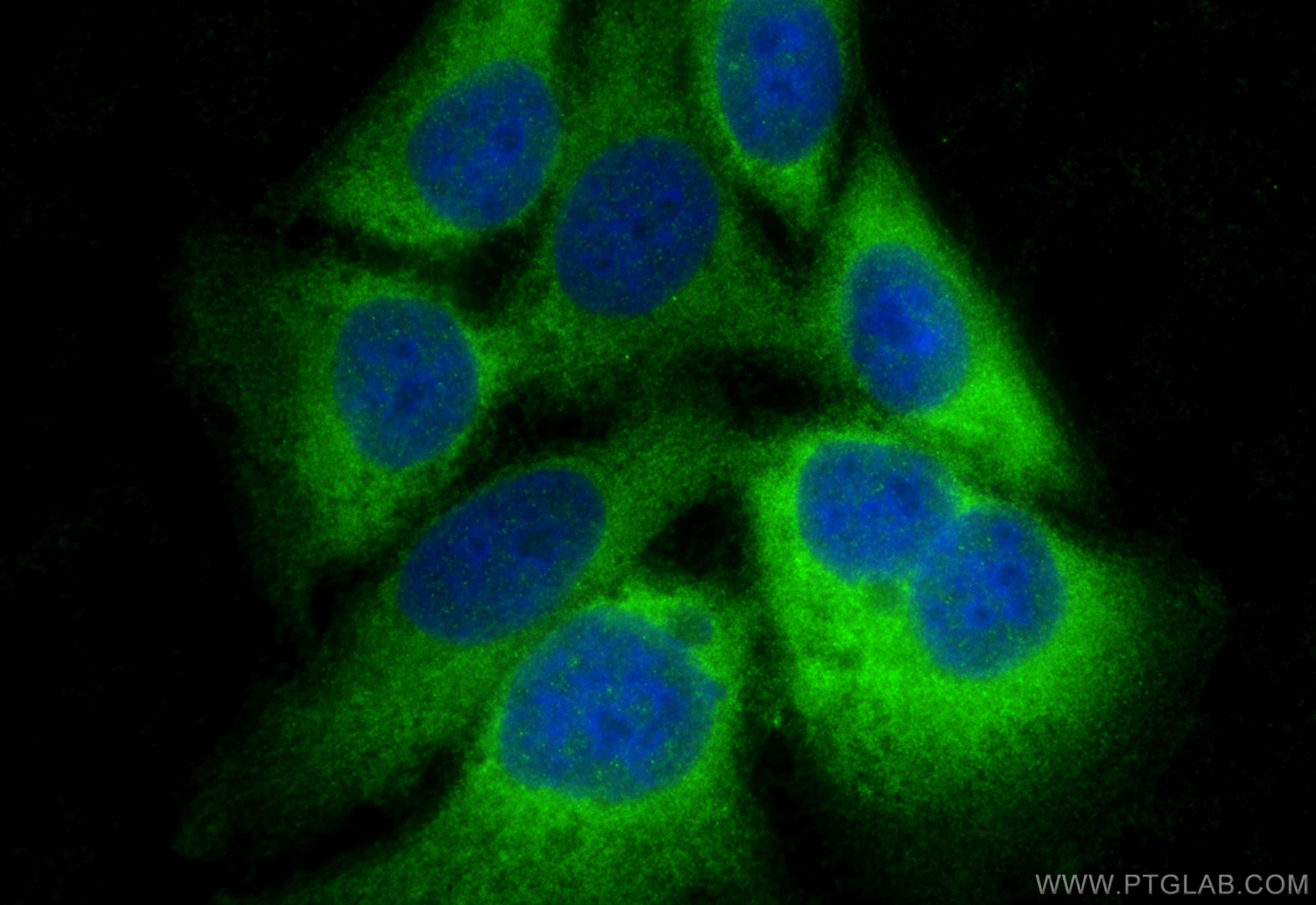 IF Staining of HepG2 using 11579-1-AP