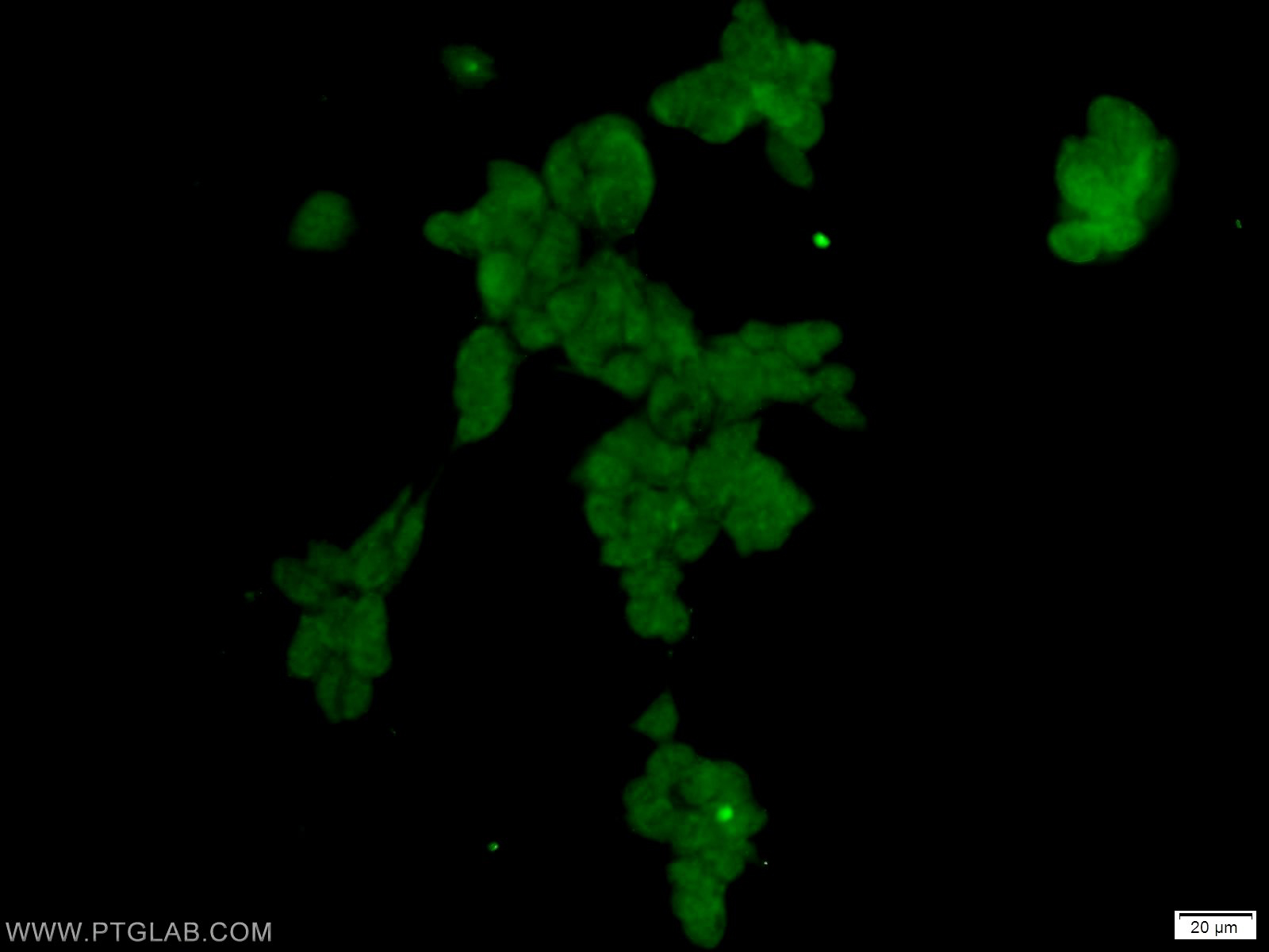 IF Staining of HEK-293 using 25544-1-AP (same clone as 25544-1-PBS)