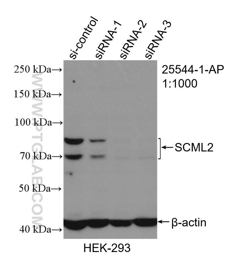 WB analysis of HEK-293 using 25544-1-AP (same clone as 25544-1-PBS)