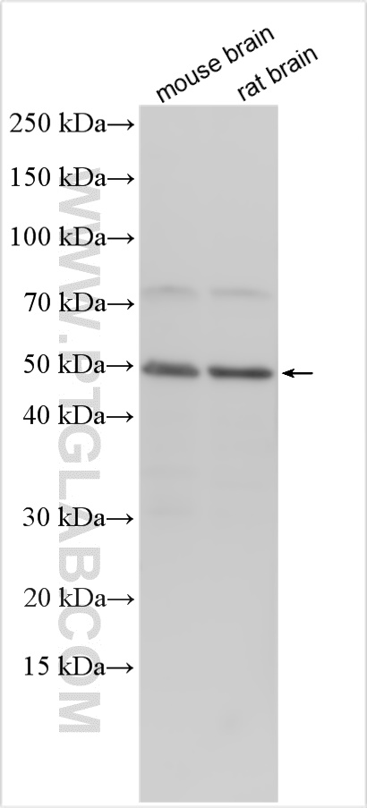 SCN3B