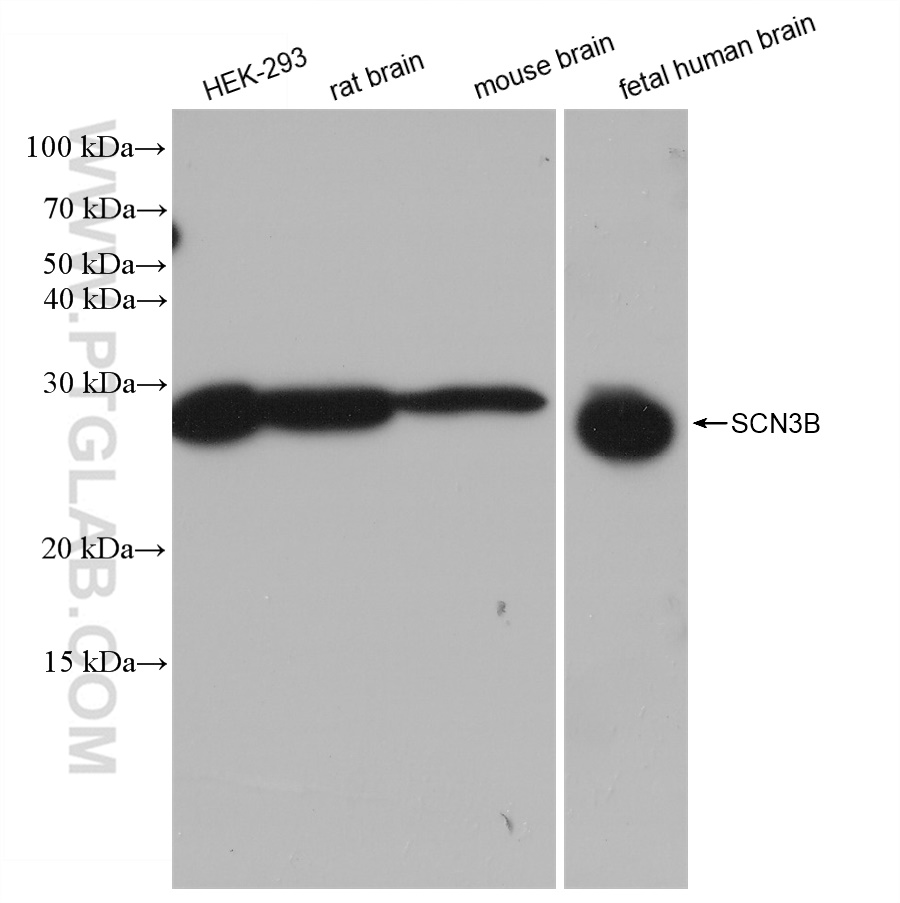 WB analysis using 82959-1-RR (same clone as 82959-1-PBS)