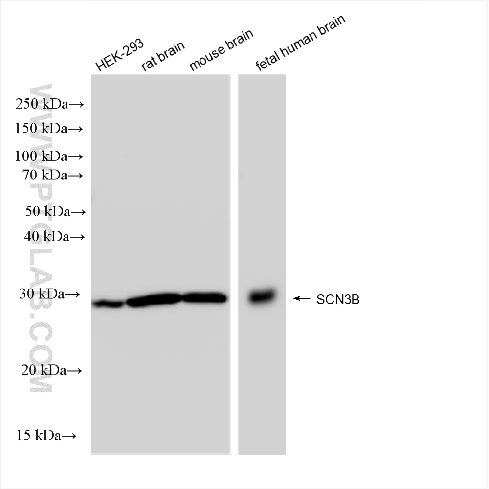 WB analysis using 82959-7-RR (same clone as 82959-7-PBS)