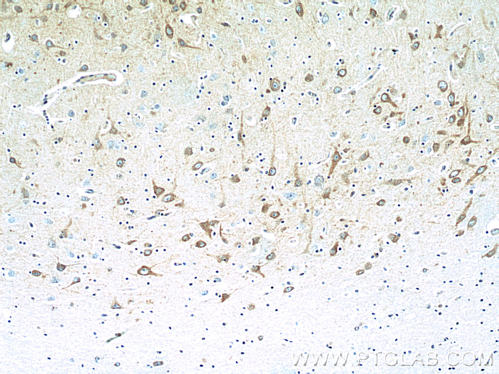 IHC staining of human brain using 20257-1-AP