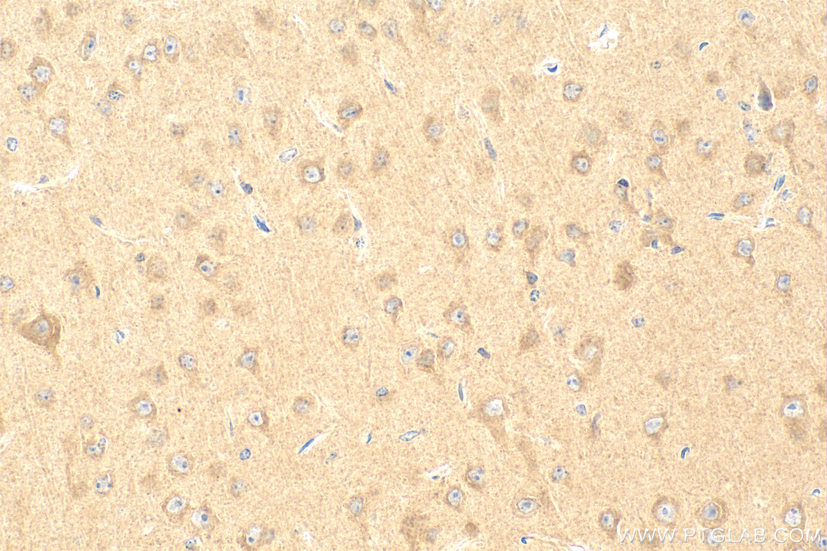 IHC staining of mouse brain using 20257-1-AP