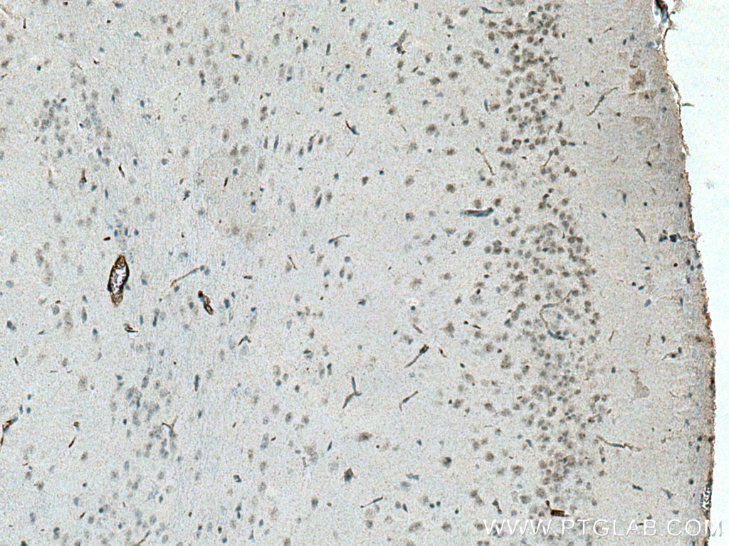 IHC staining of mouse brain using 15490-1-AP