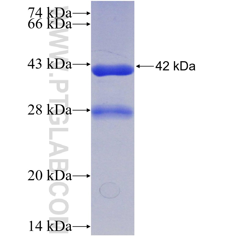 SCNN1A fusion protein Ag30063 SDS-PAGE