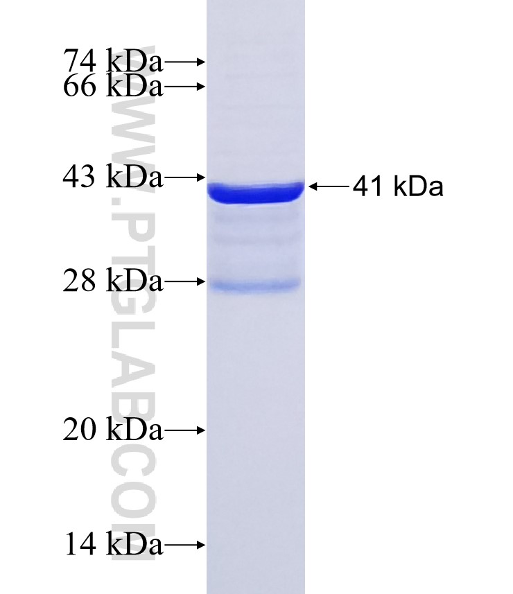 SCNN1G fusion protein Ag32176 SDS-PAGE