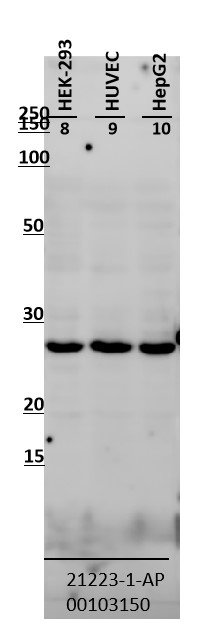 WB analysis using 21223-1-AP