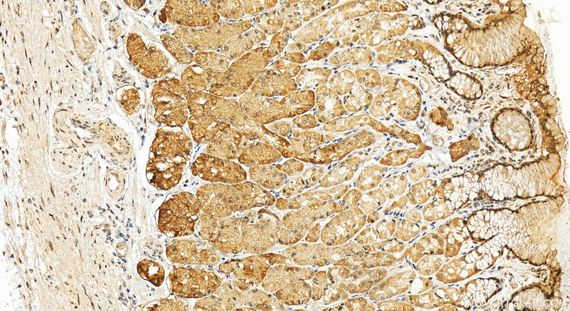 IHC staining of human stomach using 14397-1-AP