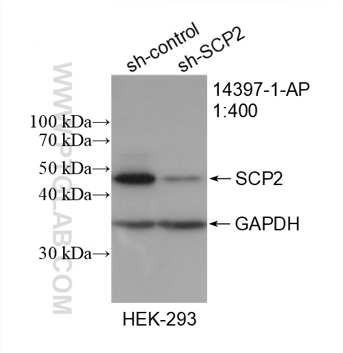 WB analysis of HEK-293 using 14397-1-AP