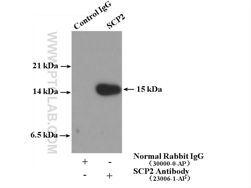 IP experiment of HepG2 using 23006-1-AP