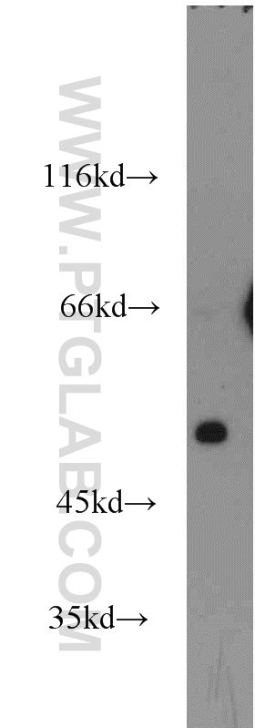 WB analysis of mouse pancreas using 14172-1-AP