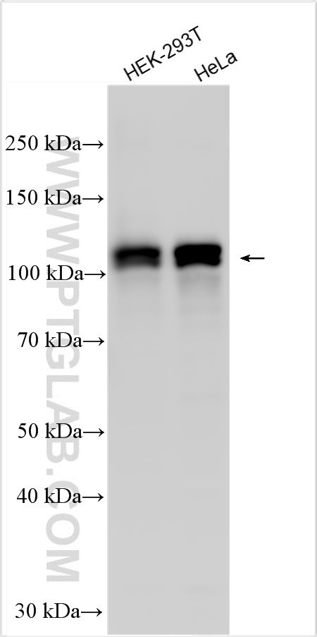 WB analysis using 31302-1-AP