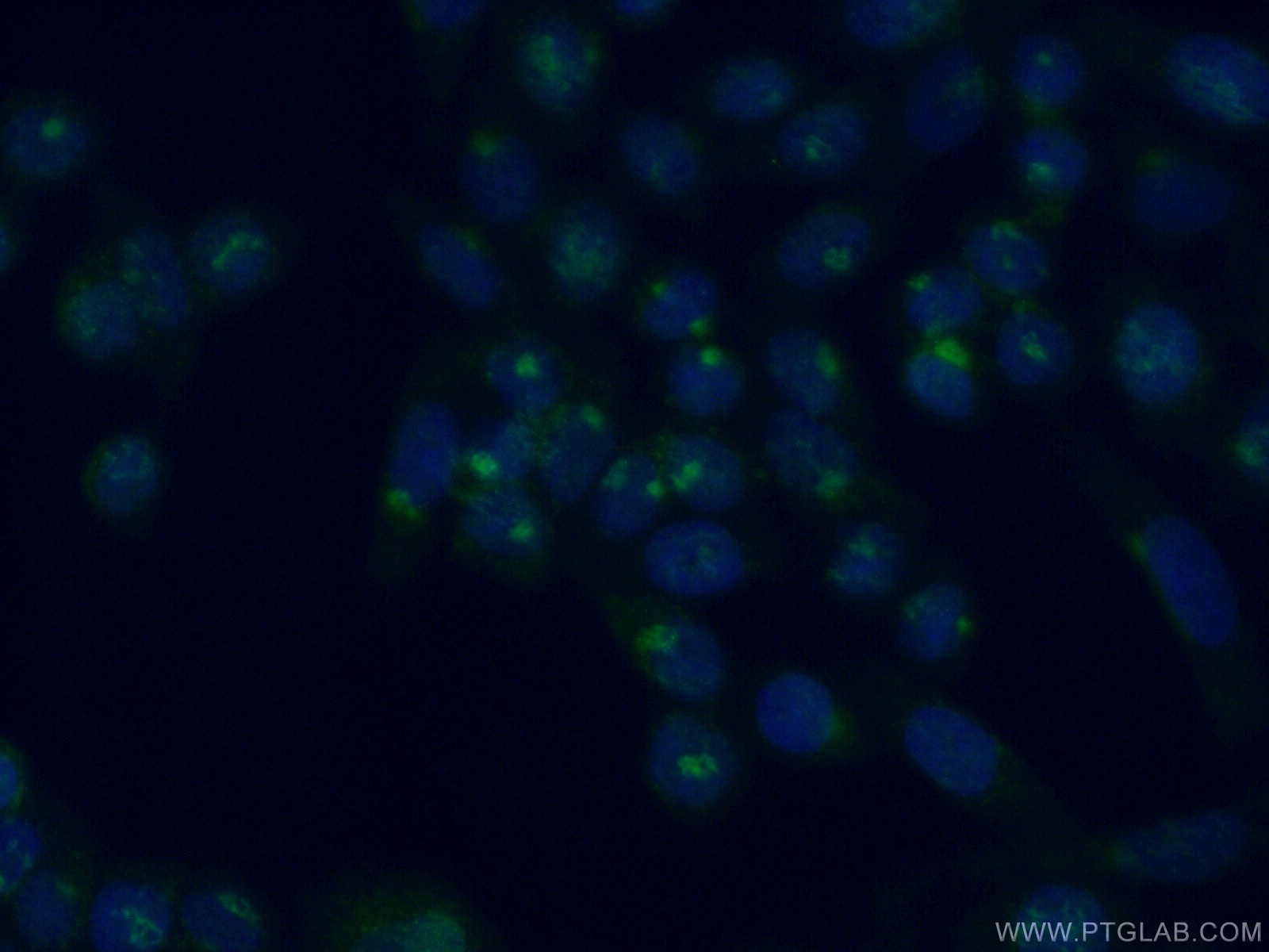 IF Staining of HeLa using 11249-1-AP