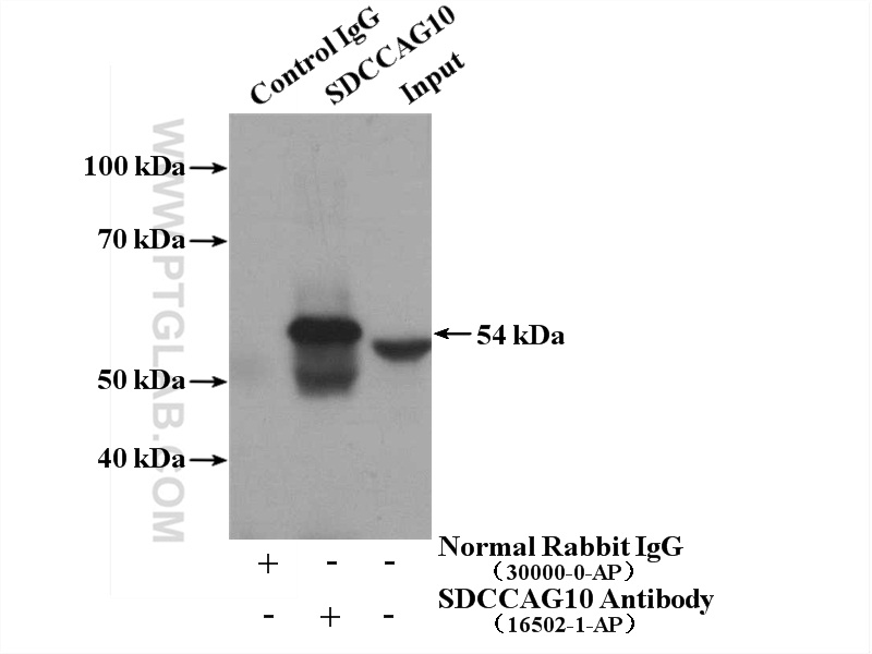 IP experiment of HepG2 using 16502-1-AP