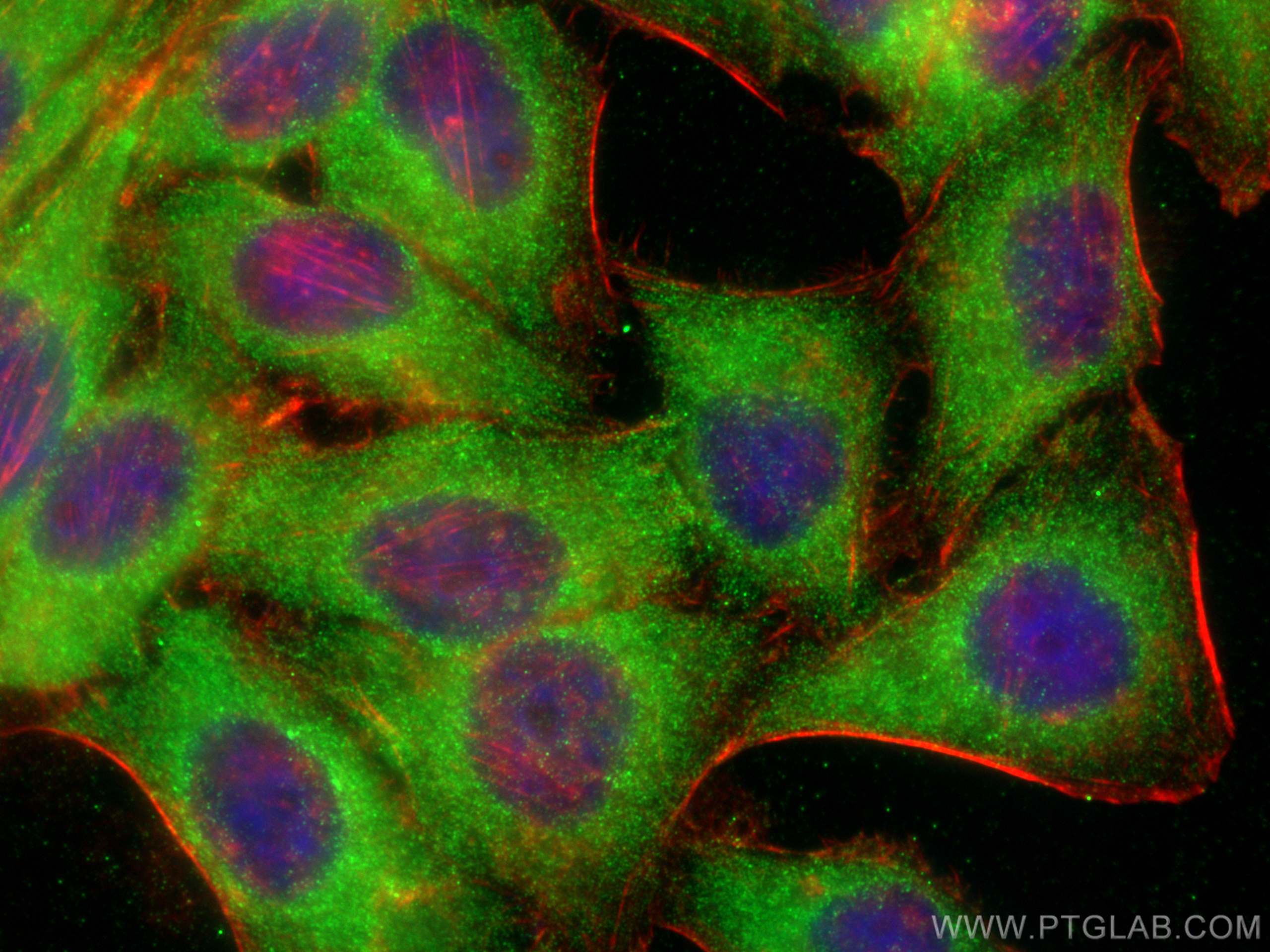 IF Staining of HepG2 using 15969-1-AP