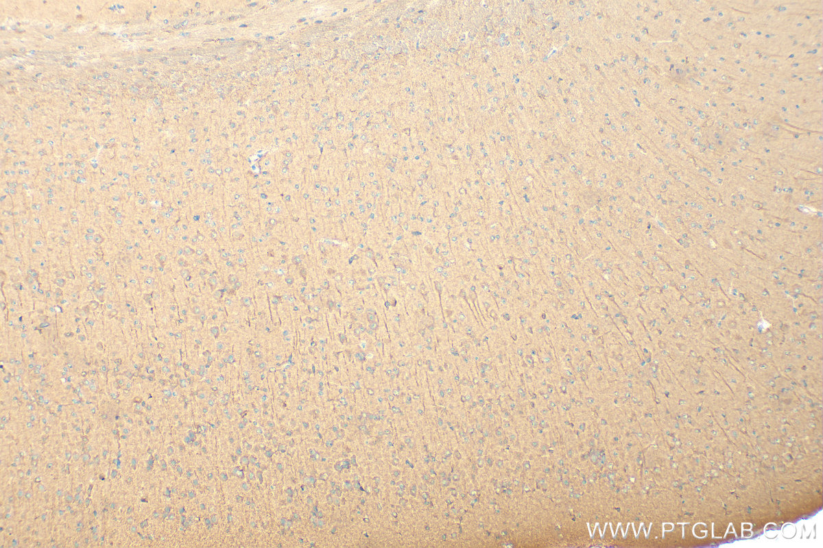 IHC staining of mouse brain using 13471-1-AP