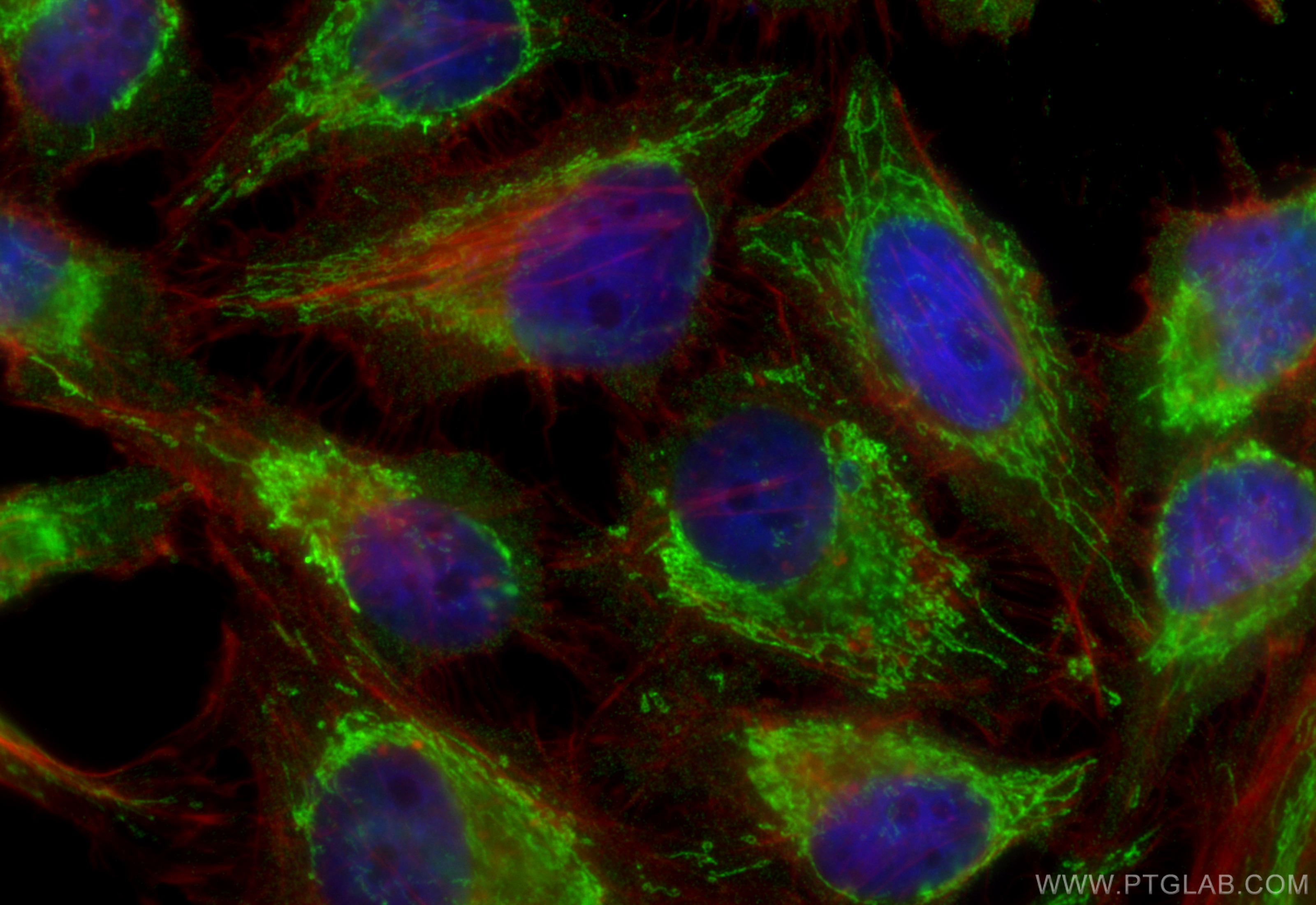 IF Staining of HeLa using 66588-1-Ig