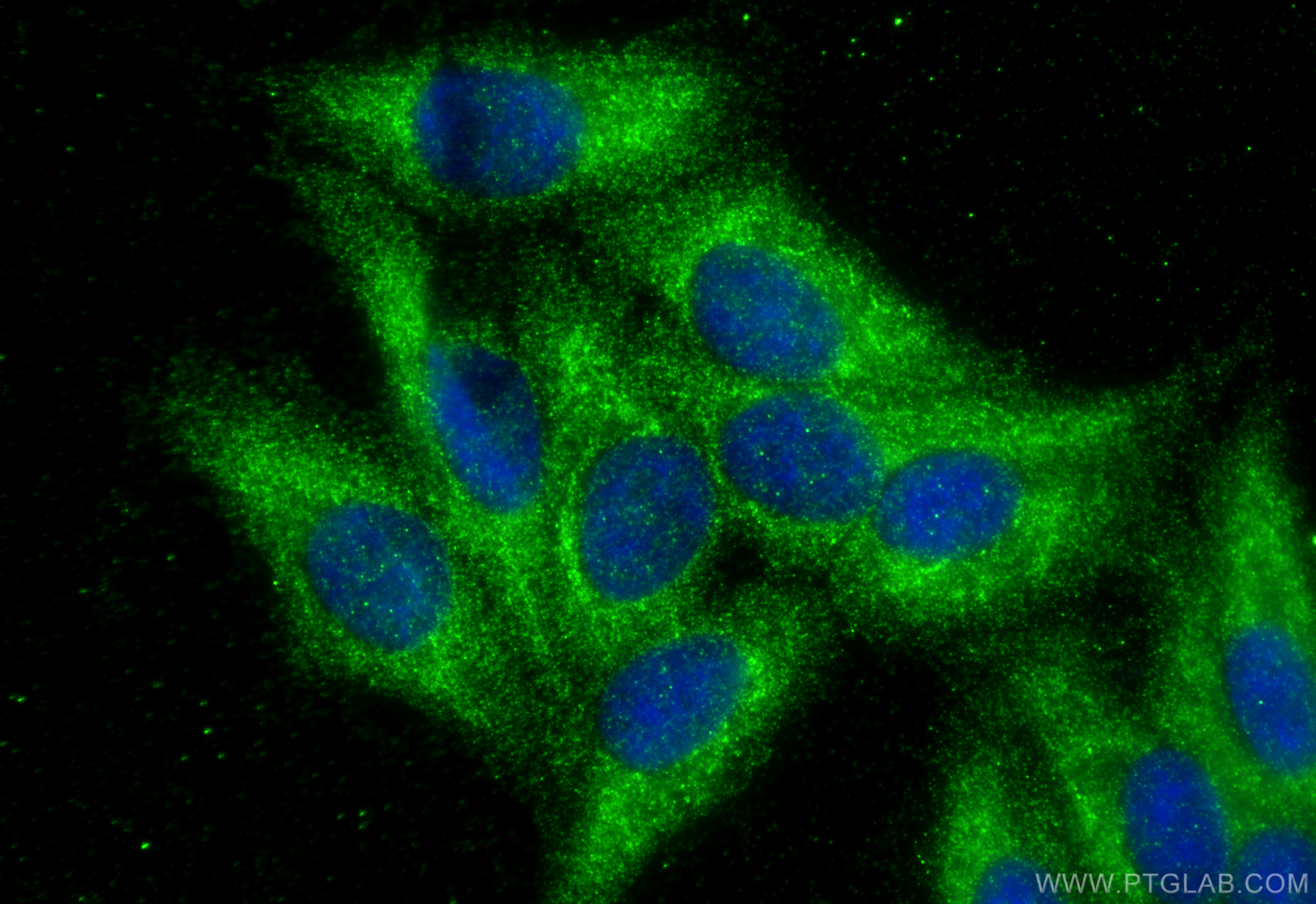 IF Staining of HepG2 using 16242-1-AP