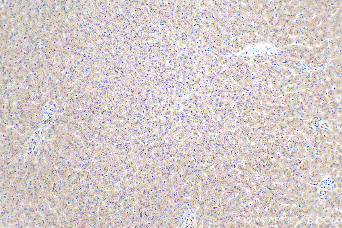 IHC staining of human liver using 16242-1-AP