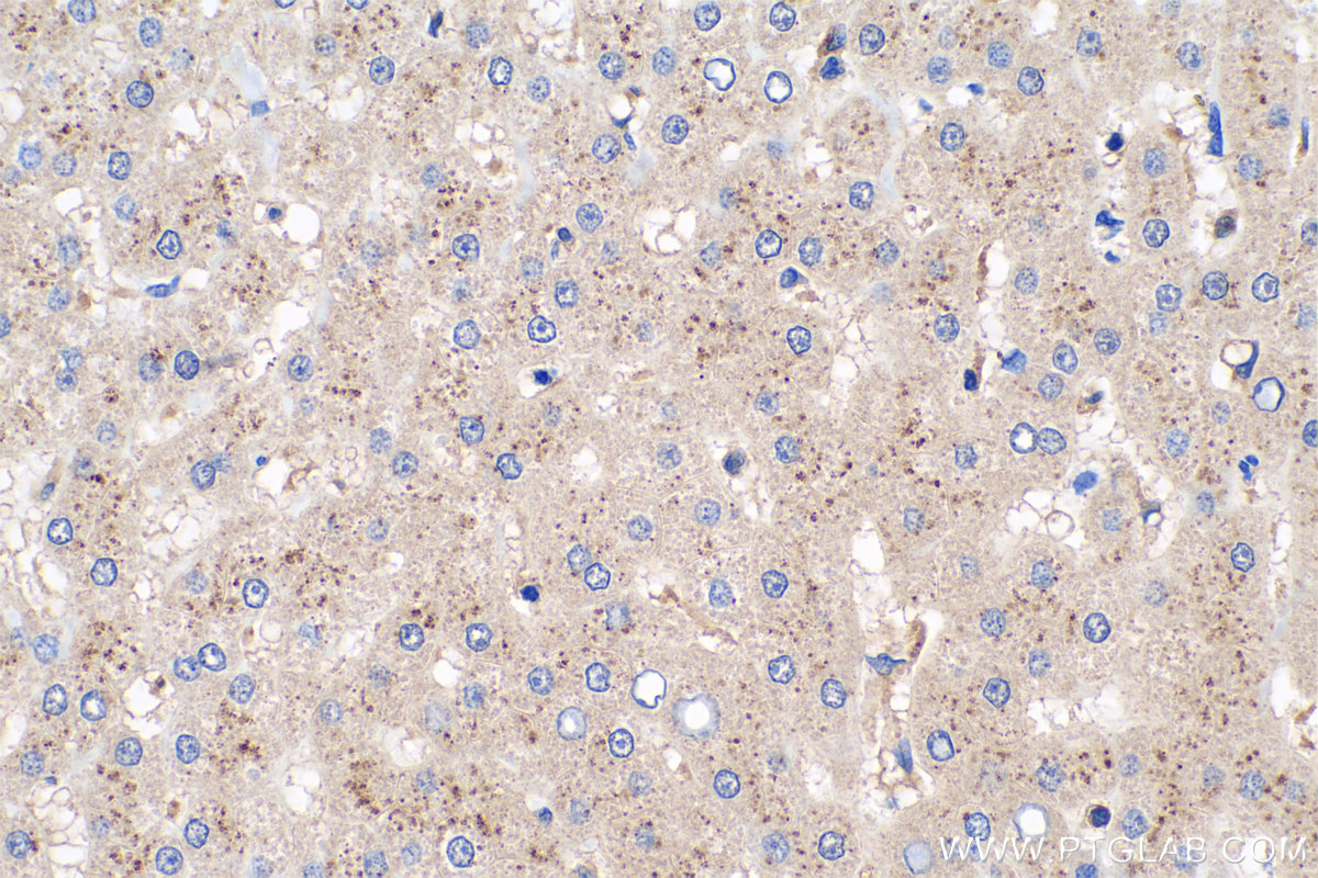 IHC staining of human liver using 16242-1-AP