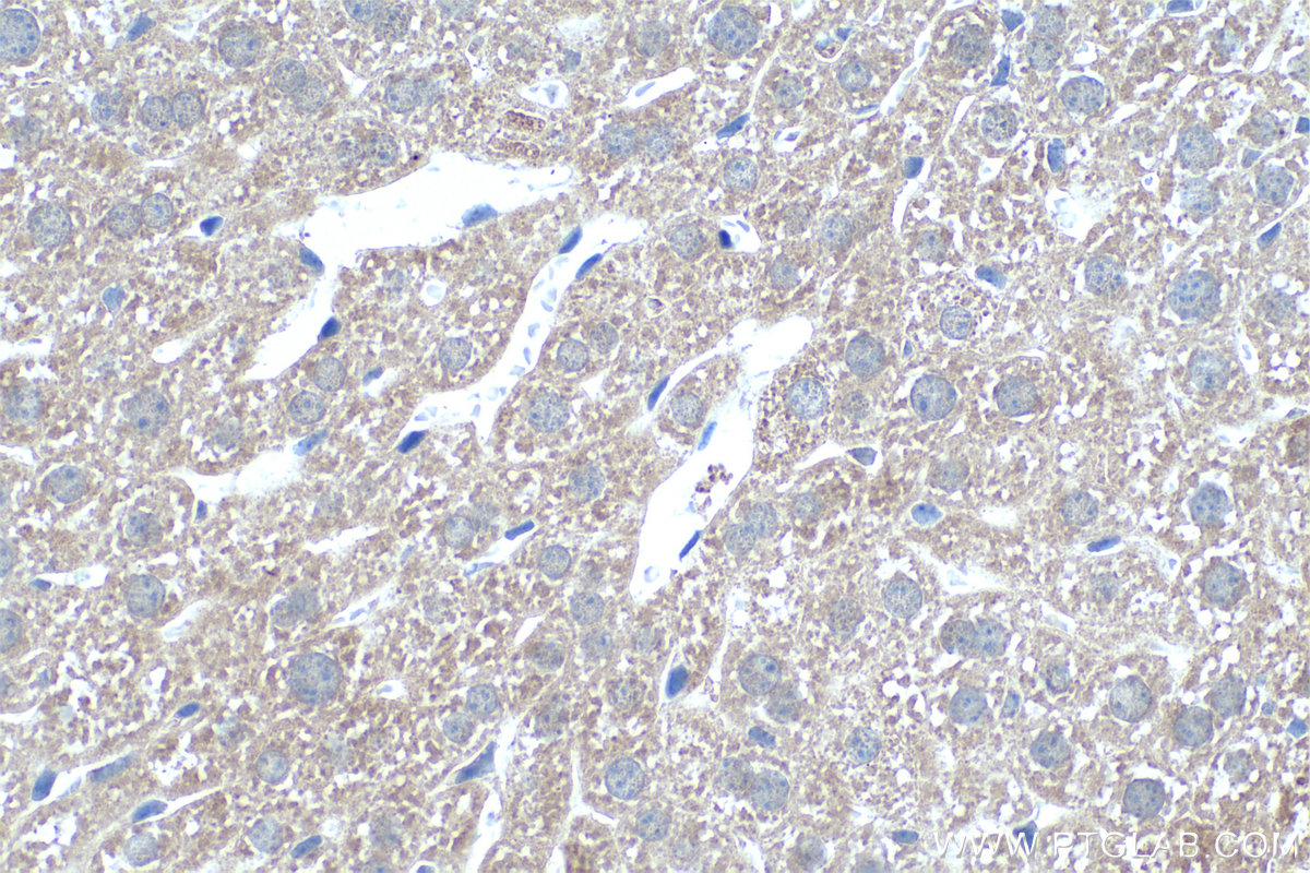 IHC staining of mouse liver using 16242-1-AP