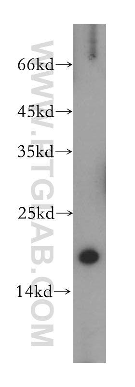 WB analysis of mouse testis using 14753-1-AP