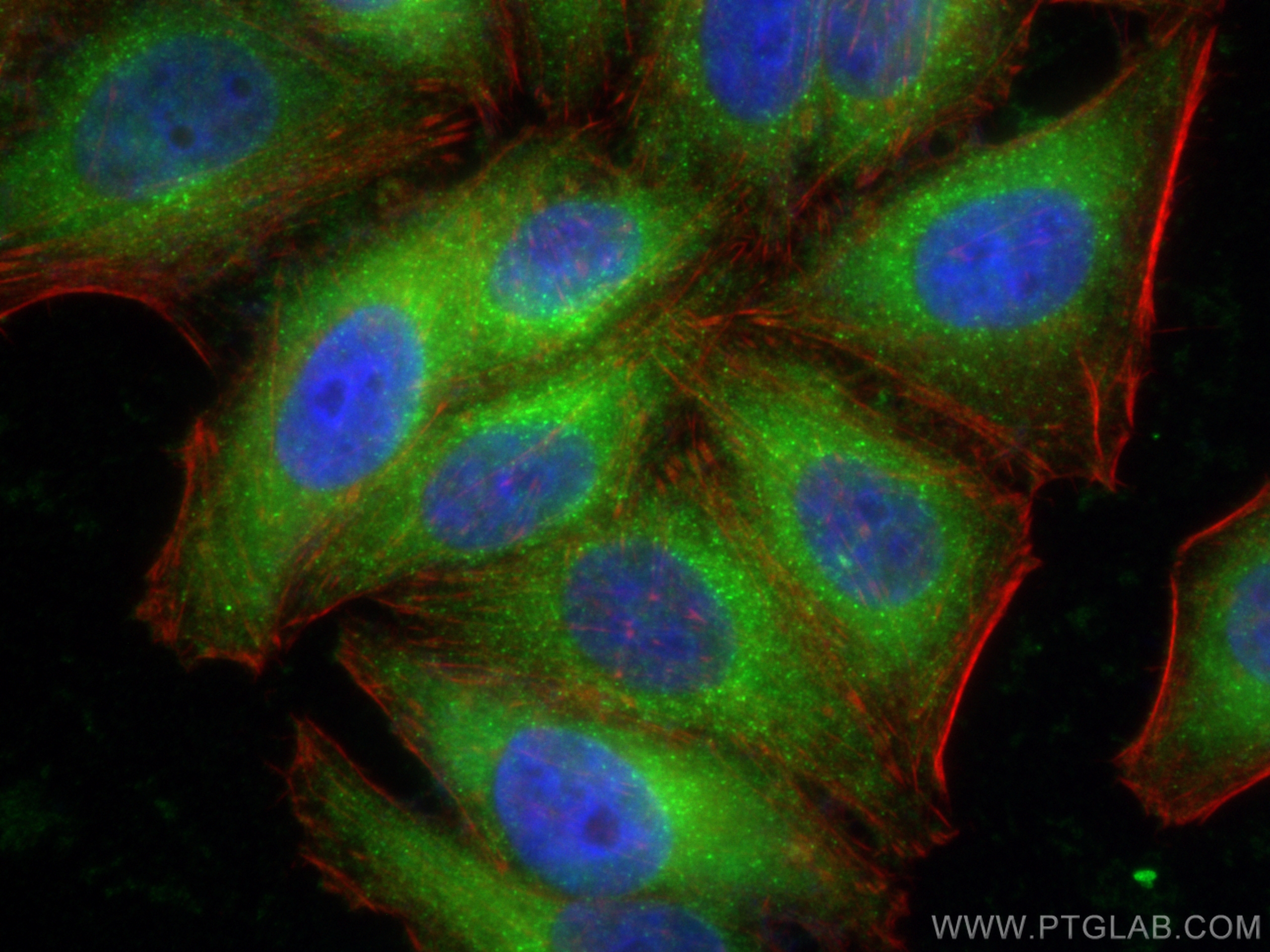 IF Staining of HepG2 using 15397-1-AP