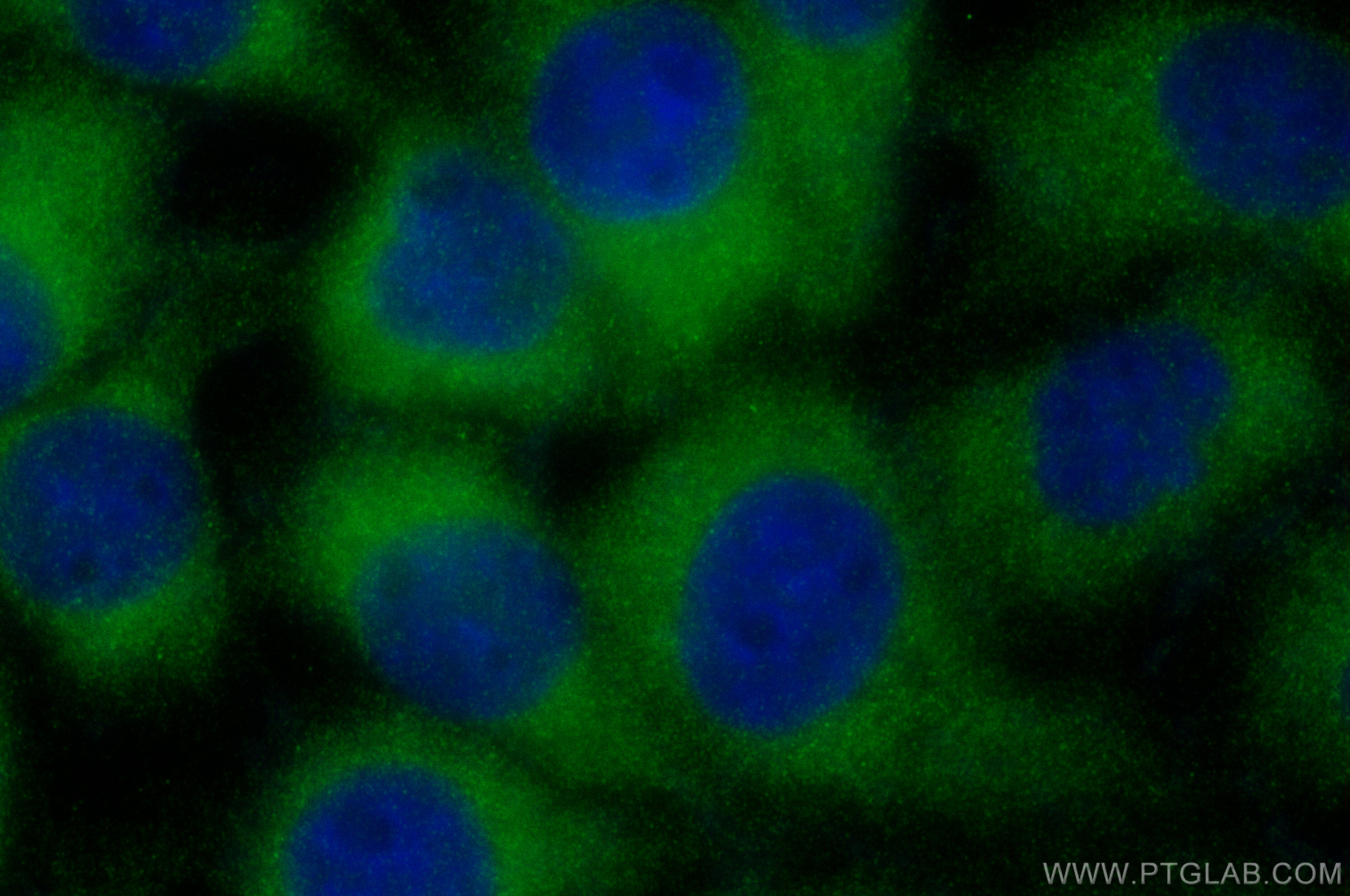 IF Staining of A431 using 25541-1-AP