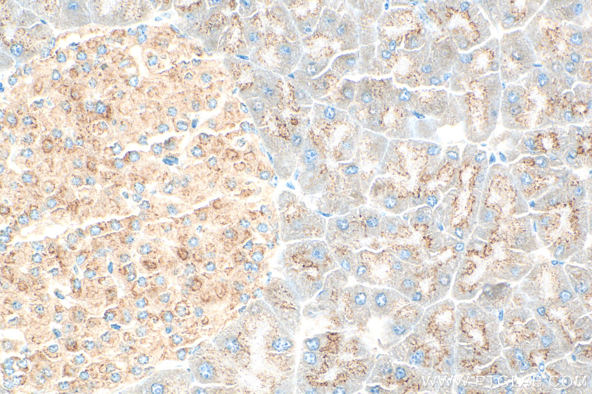 IHC staining of mouse pancreas using 20025-1-AP