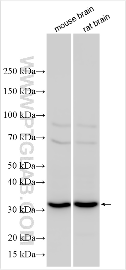 SEC22A