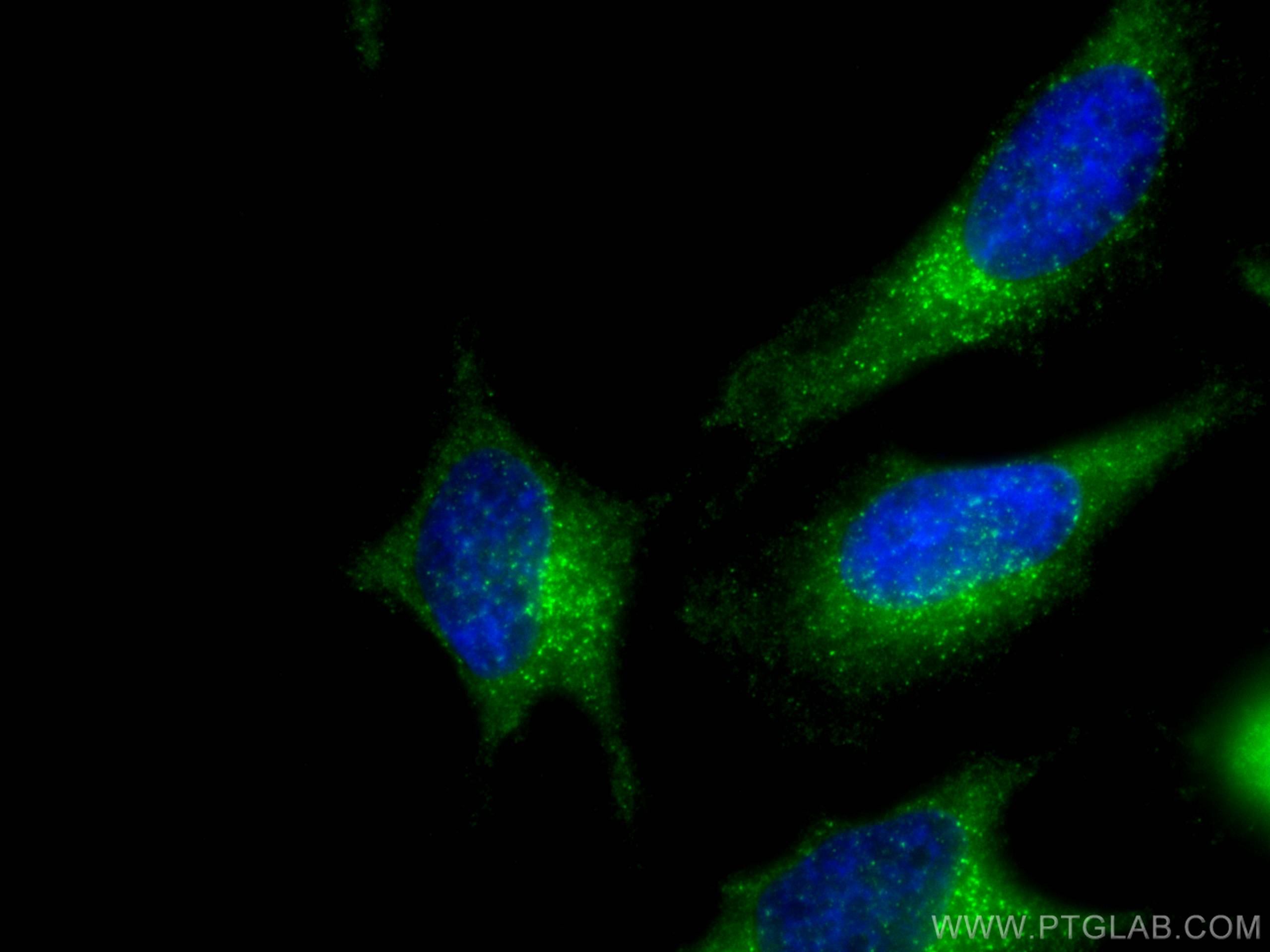 IF Staining of HeLa using 20892-1-AP